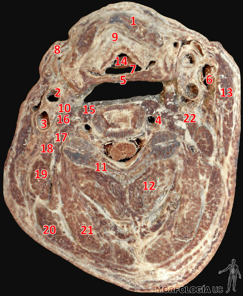 Fig. 1-18 Cabeza y Cuello