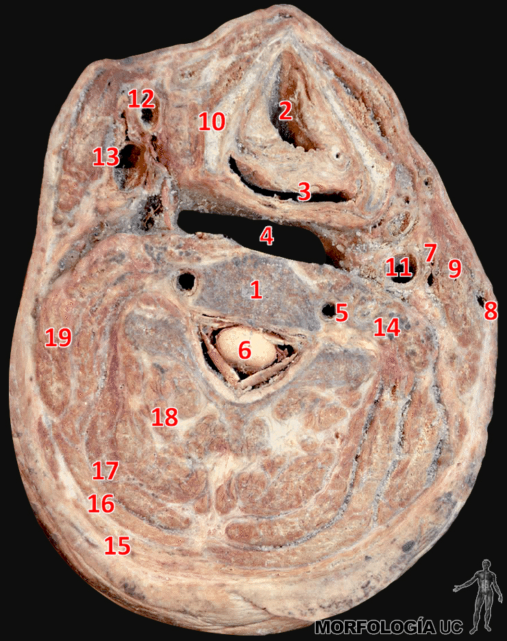 Fig. 1-19 Cabeza y Cuello